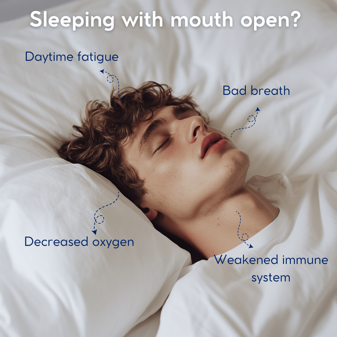 NightSeal™ Gentle Mouth Tape - Yawnic